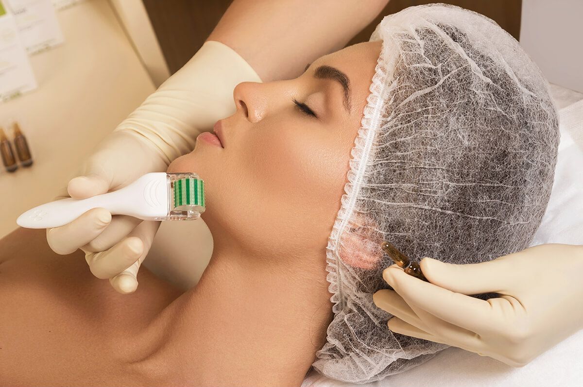 Microneedling